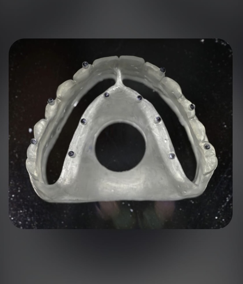 Digital dentistry workflow